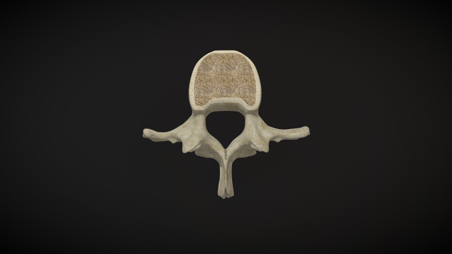 3D model Vertebra Lumbar / Lumbar Vertebrae - This is a 3D model of the Vertebra Lumbar / Lumbar Vertebrae. The 3D model is about a skull with a black background.