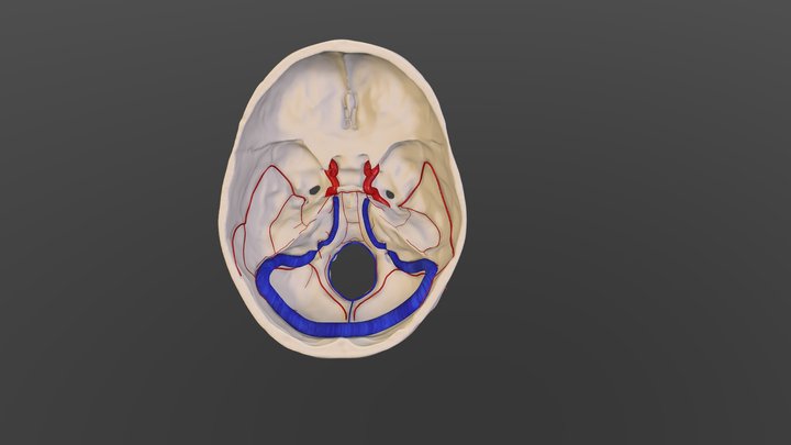 Posterior Fossa dAVF Vascular Model 3D Model