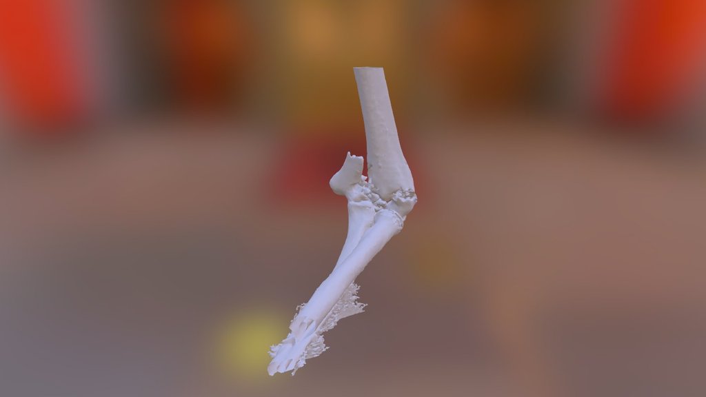 Distal Humerus Fracture - sku278 - Download Free 3D model by orto3d ...