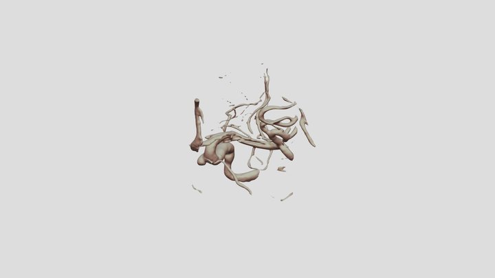 3D SR File 3D Model