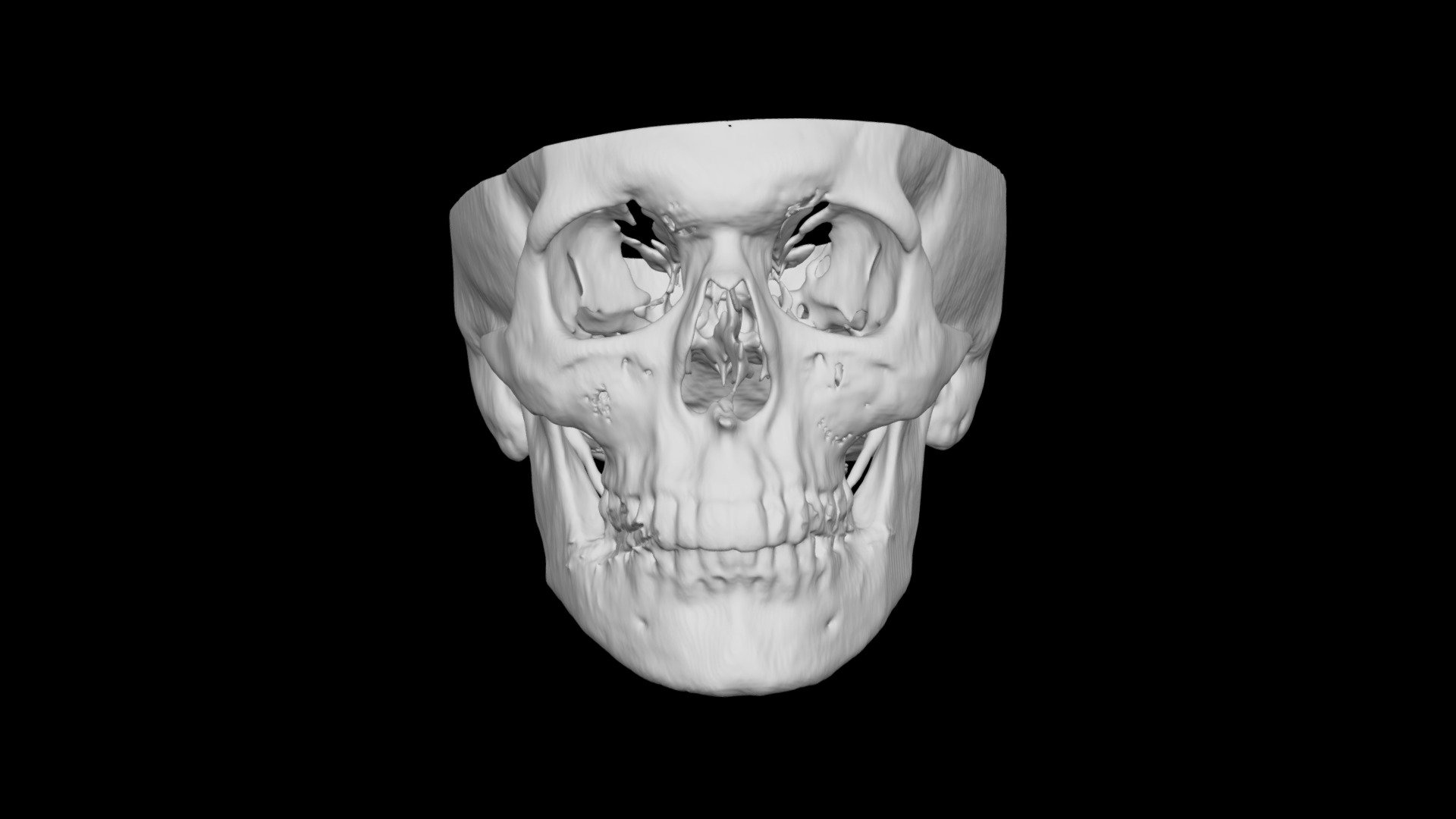 Skull Male 47yo