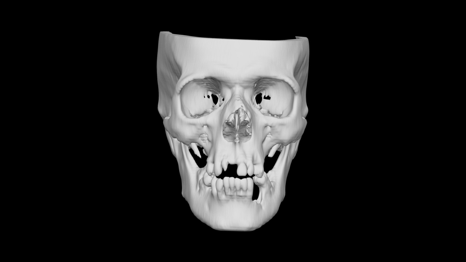 Skull Male 60yo