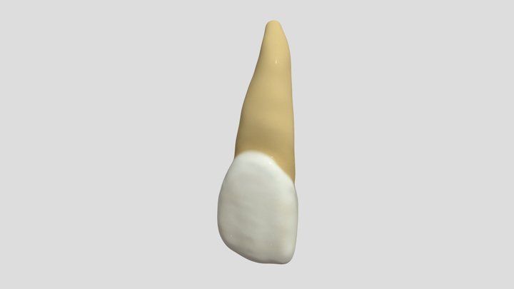 Maxillary Lateral Incisor (Right)