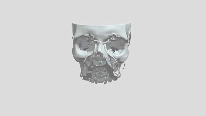 Segmentation Segment 2spt 3D Model