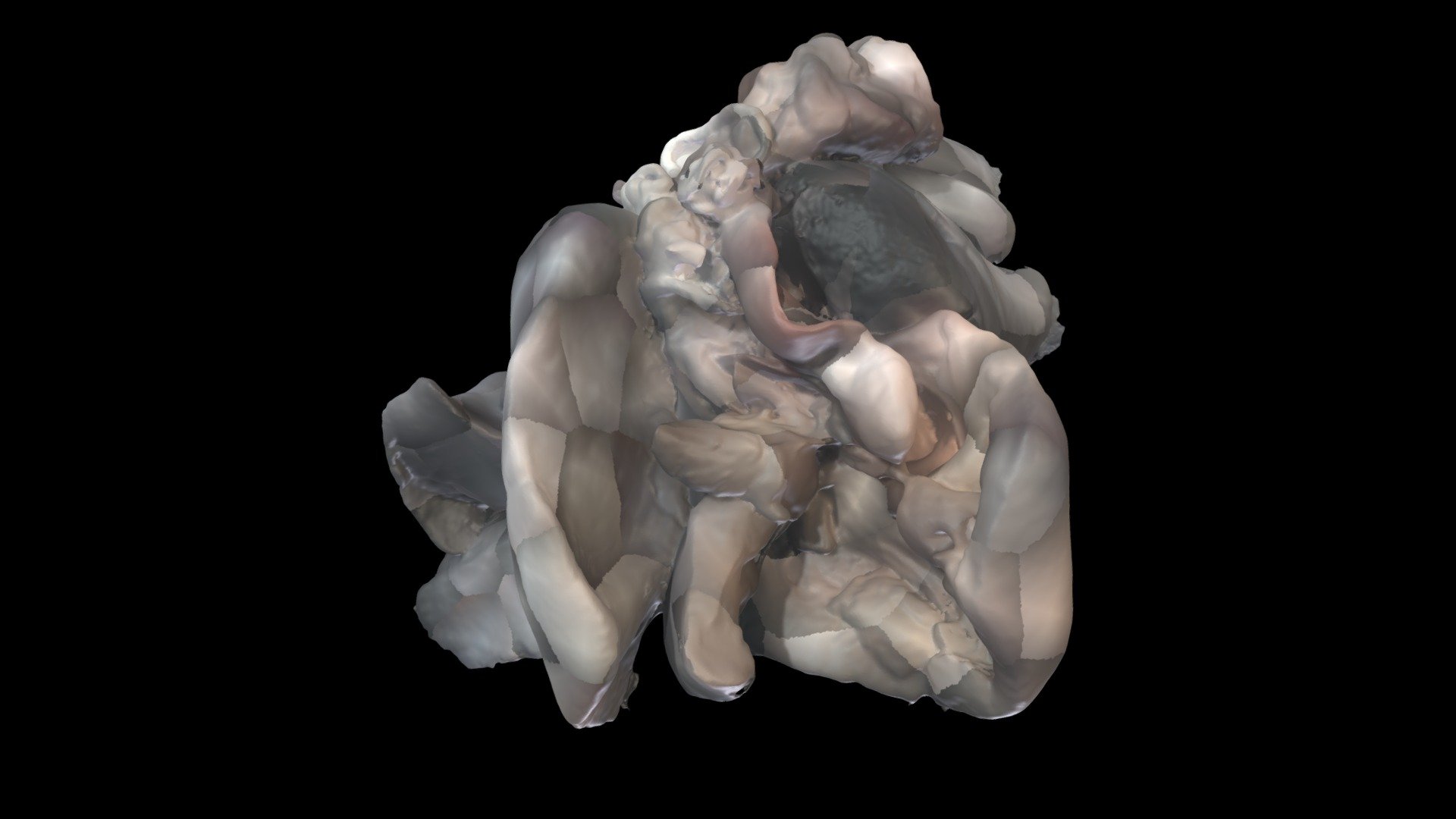 Double inlet double outlet I-334 - 3D model by Rohit Loomba (@loomba ...