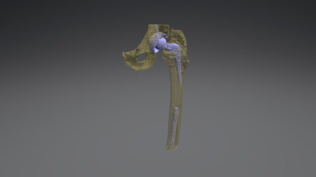Femur case 3D Model