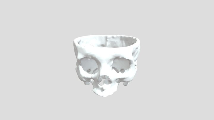 Medical Skull Model (CT Scan Data)