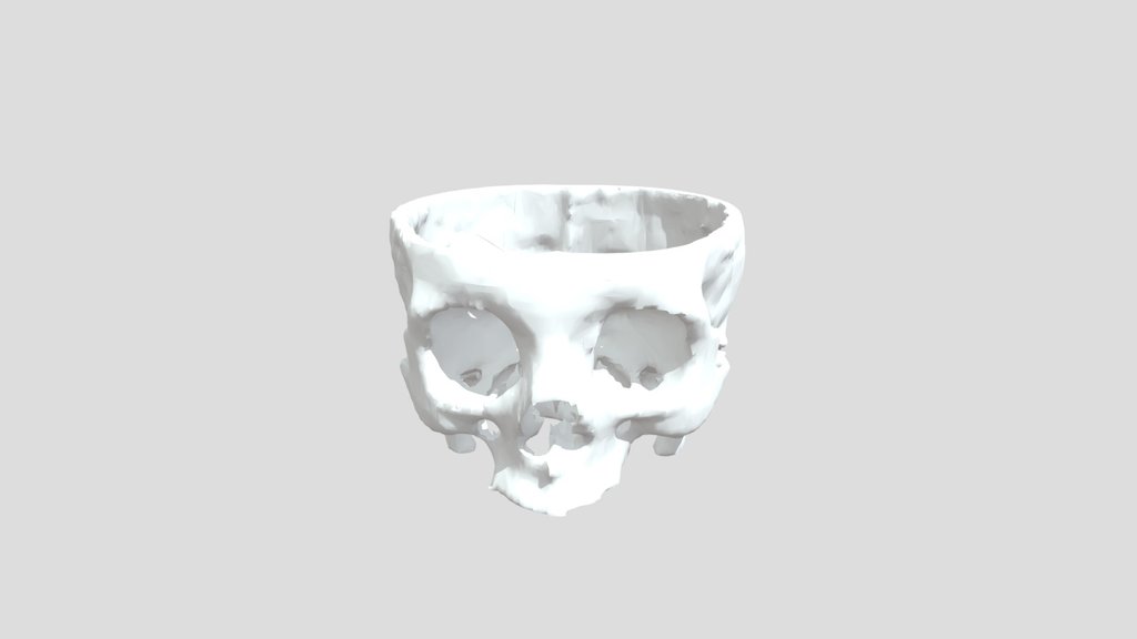 Medical Skull Model (CT Scan Data)