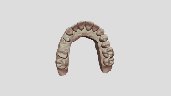 1 Upper Jaw Scan 3D Model