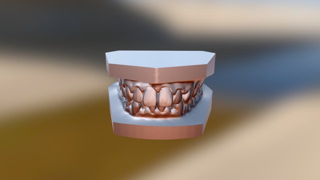 矯正前0602 3D Model