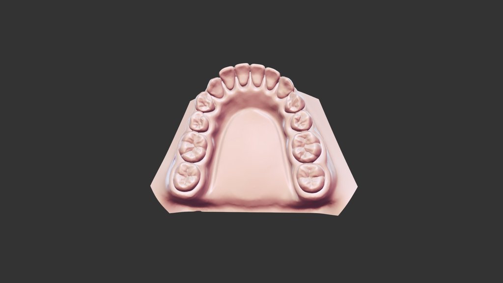 University of Michigan Virtual Dental Library - A 3D model collection ...