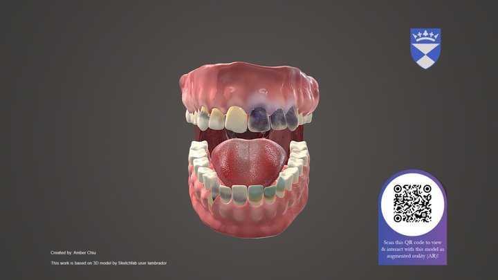 Prescription Drugs Exposure Pattern 3D Model