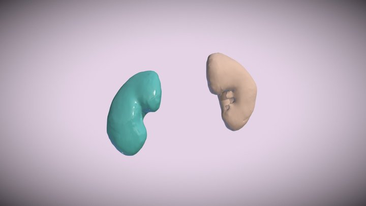 CTA Cardio Segmentations -- Kidney Pair 3D Model
