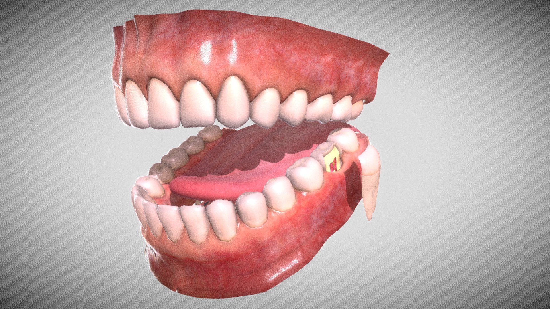 Teeth Denture gums and tongue cutted tooth