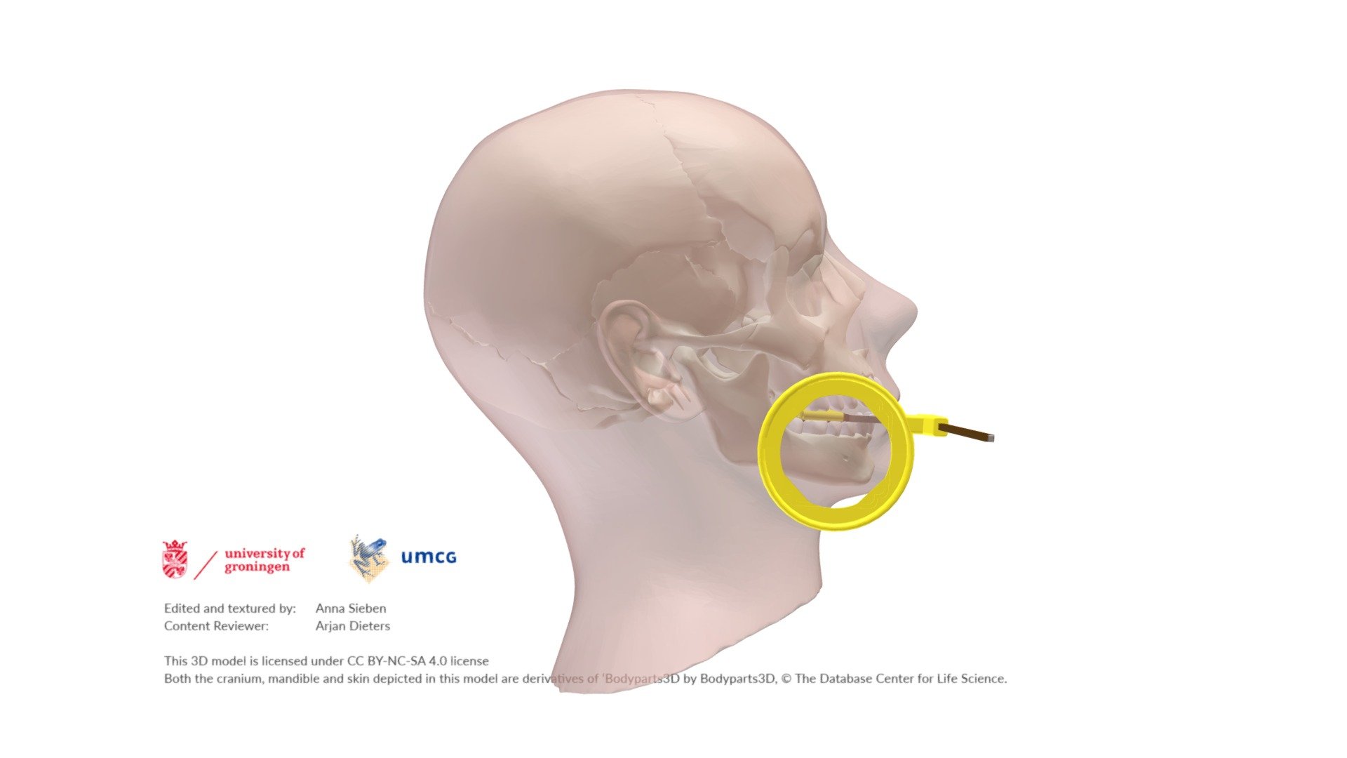 Dental Intra oral X-ray Pos - empty annotation