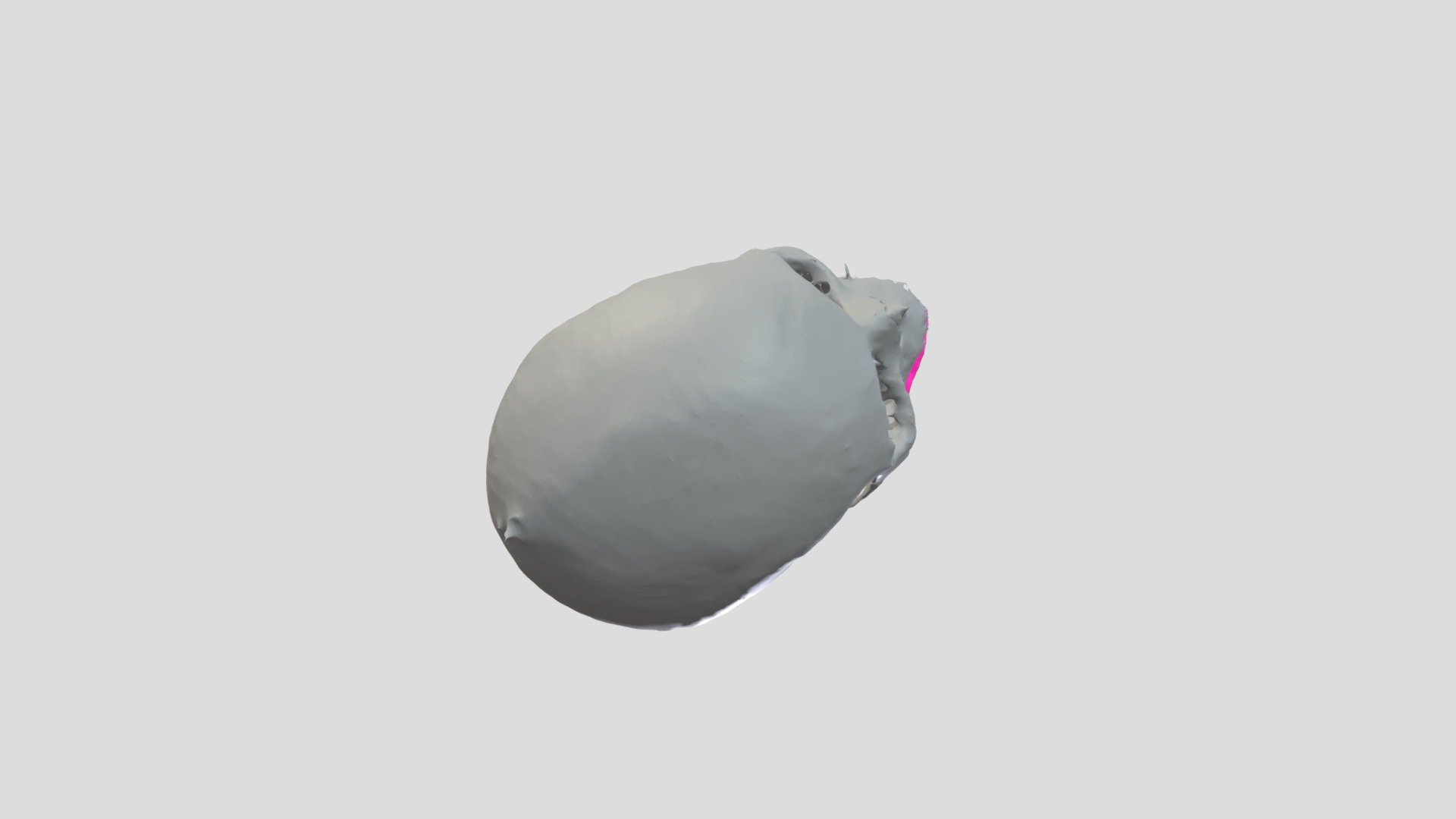 9631 Female: Mandible and Skull Segmentation