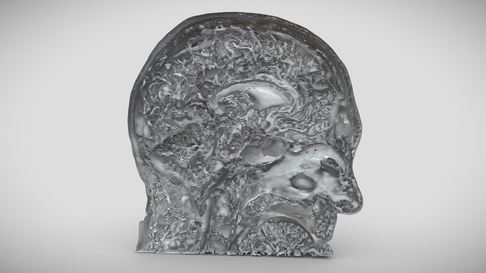 Human Head 3D vascular study 3D model by Advanced Visualization Lab