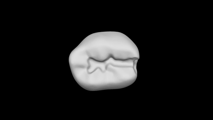 Tooth #K Class II Preparation 3D Model