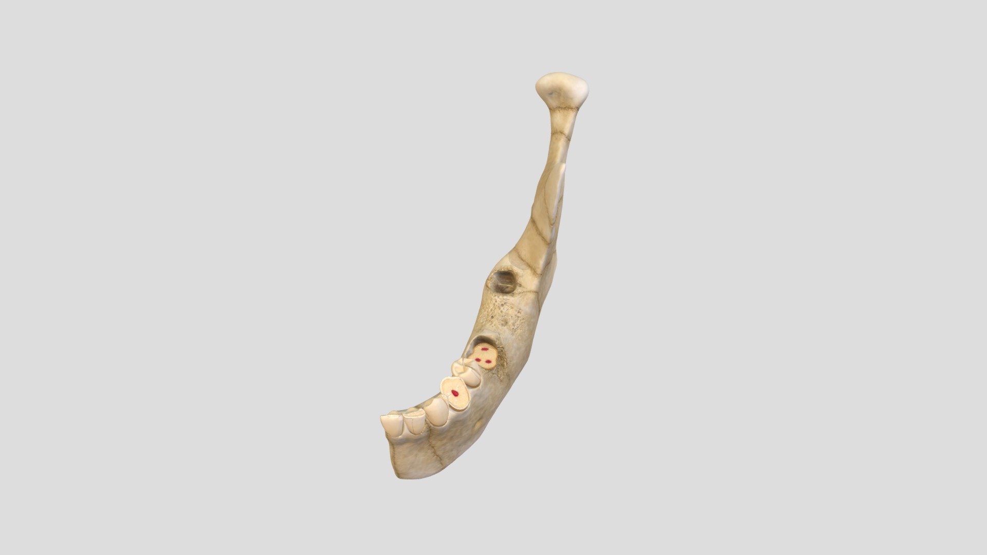 Dental and Mandibular Trauma