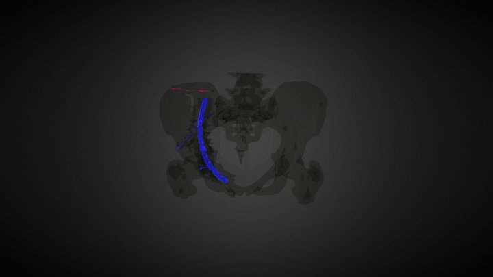 Smith_ Pelvix 3D Model