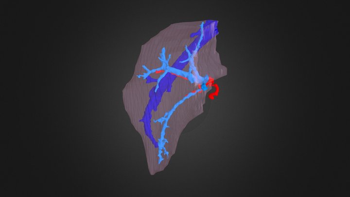 3graft MS 3D Model