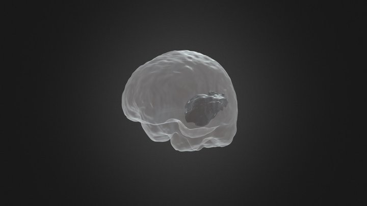 Segmentation 3D Model