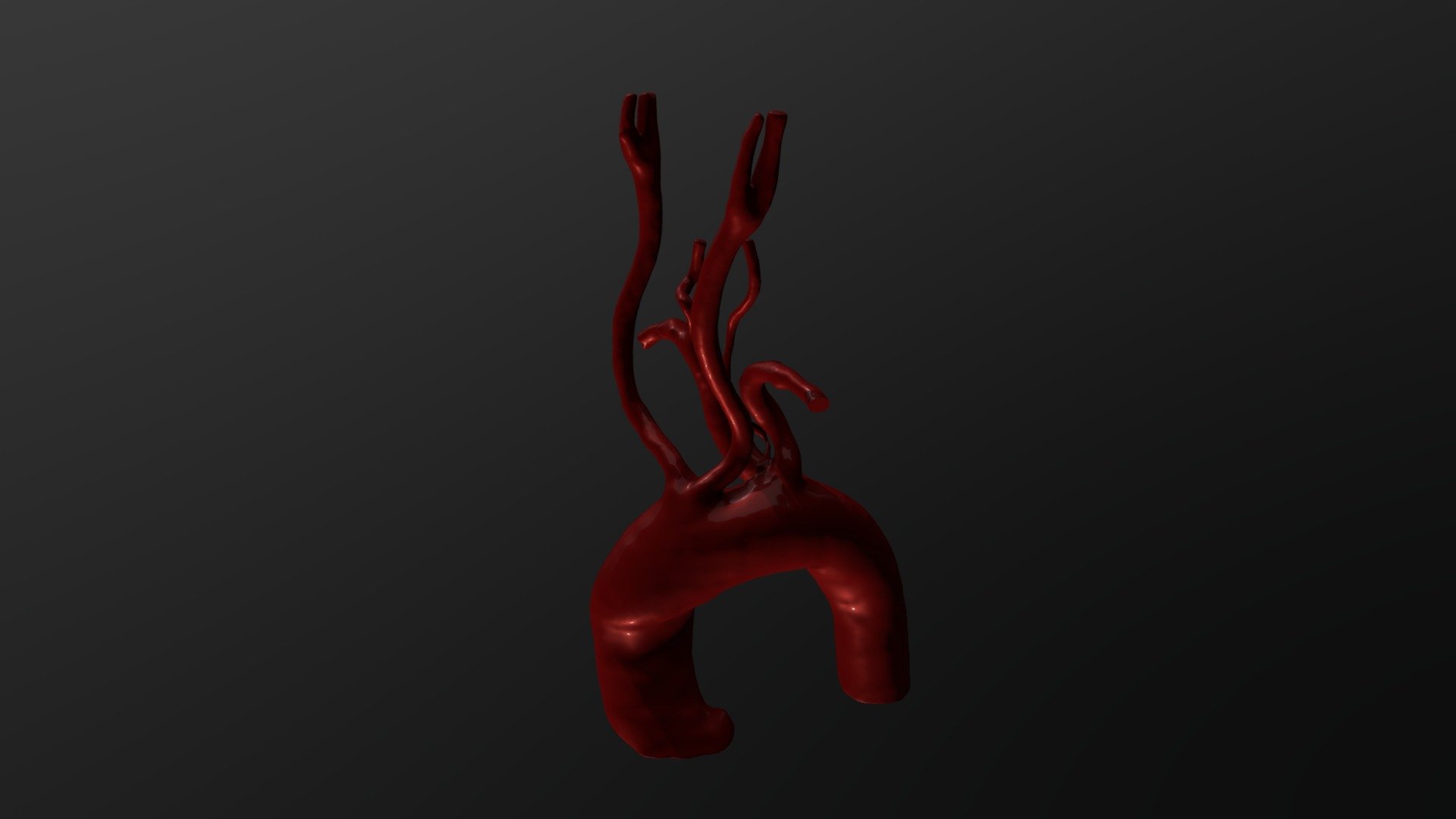 Artery Lusoria Reconstruction - 3D model by Ivailo.Dimitrov [427bce9 ...