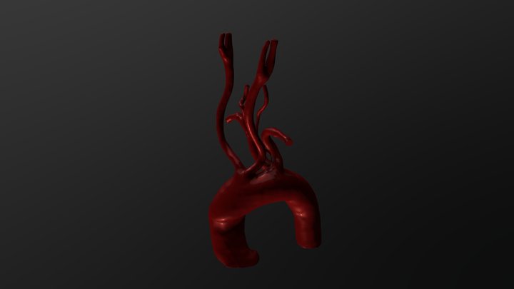 Artery Lusoria Reconstruction 3D Model