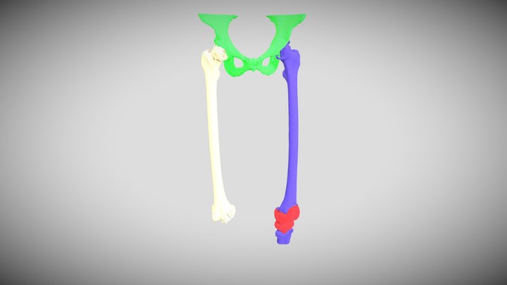 Femur Segmentation 3D Model