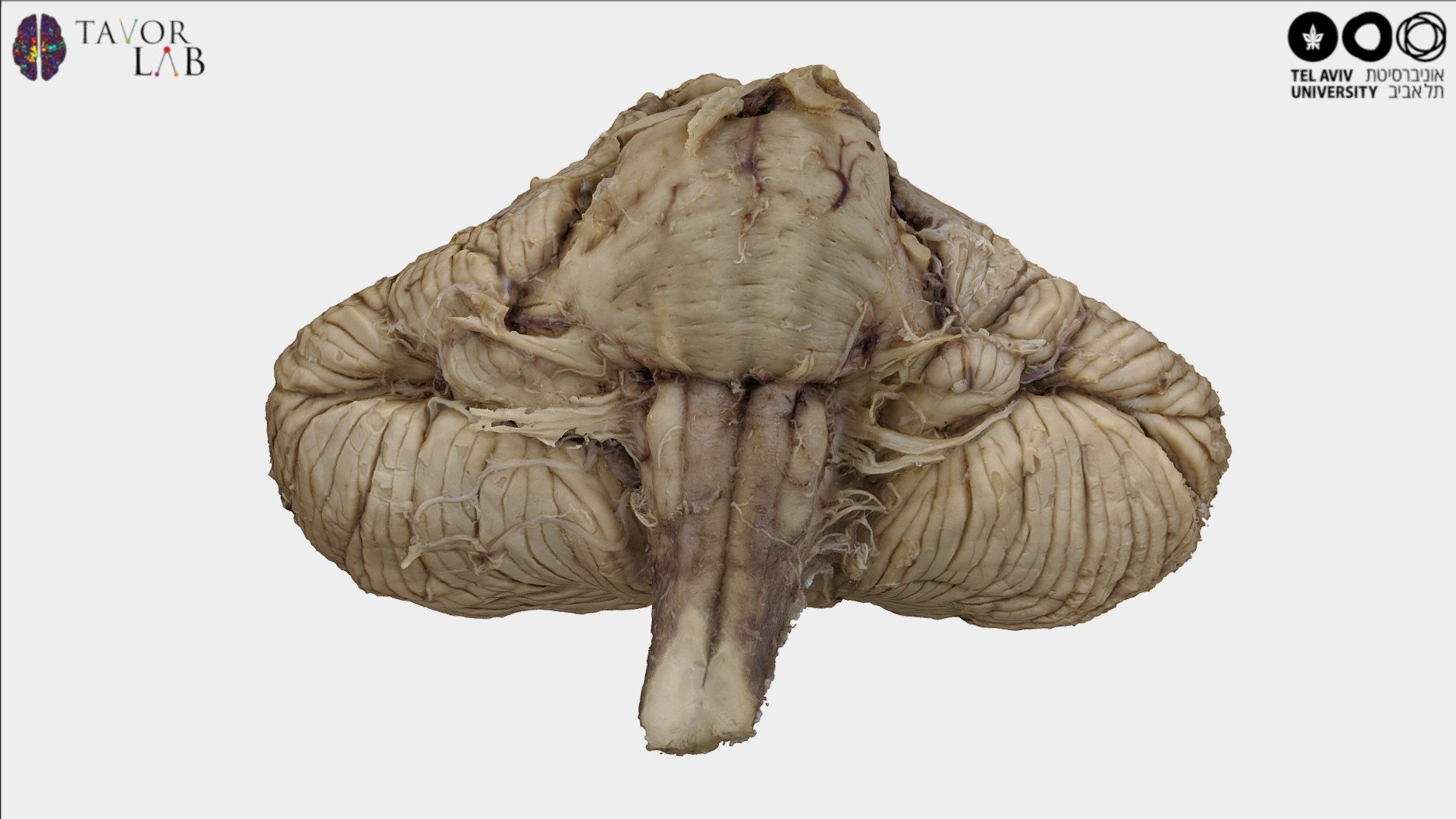 Brainstem - 3D Model By TavorLab (@IT_Lab) [428e12b] - Sketchfab