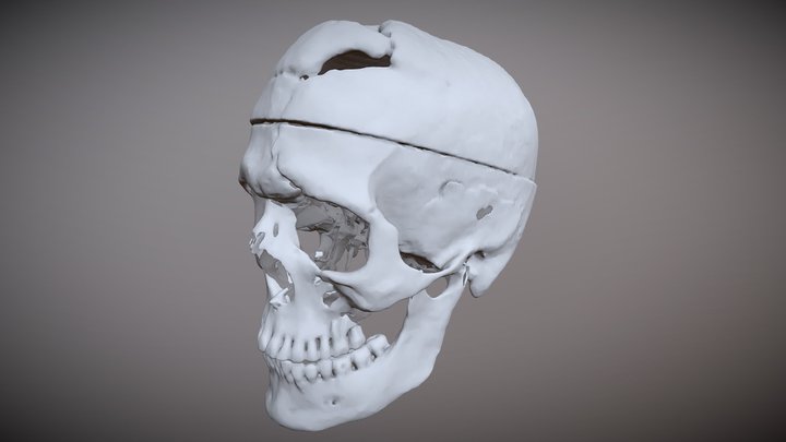 Skull of Phineas Gage 3D Model