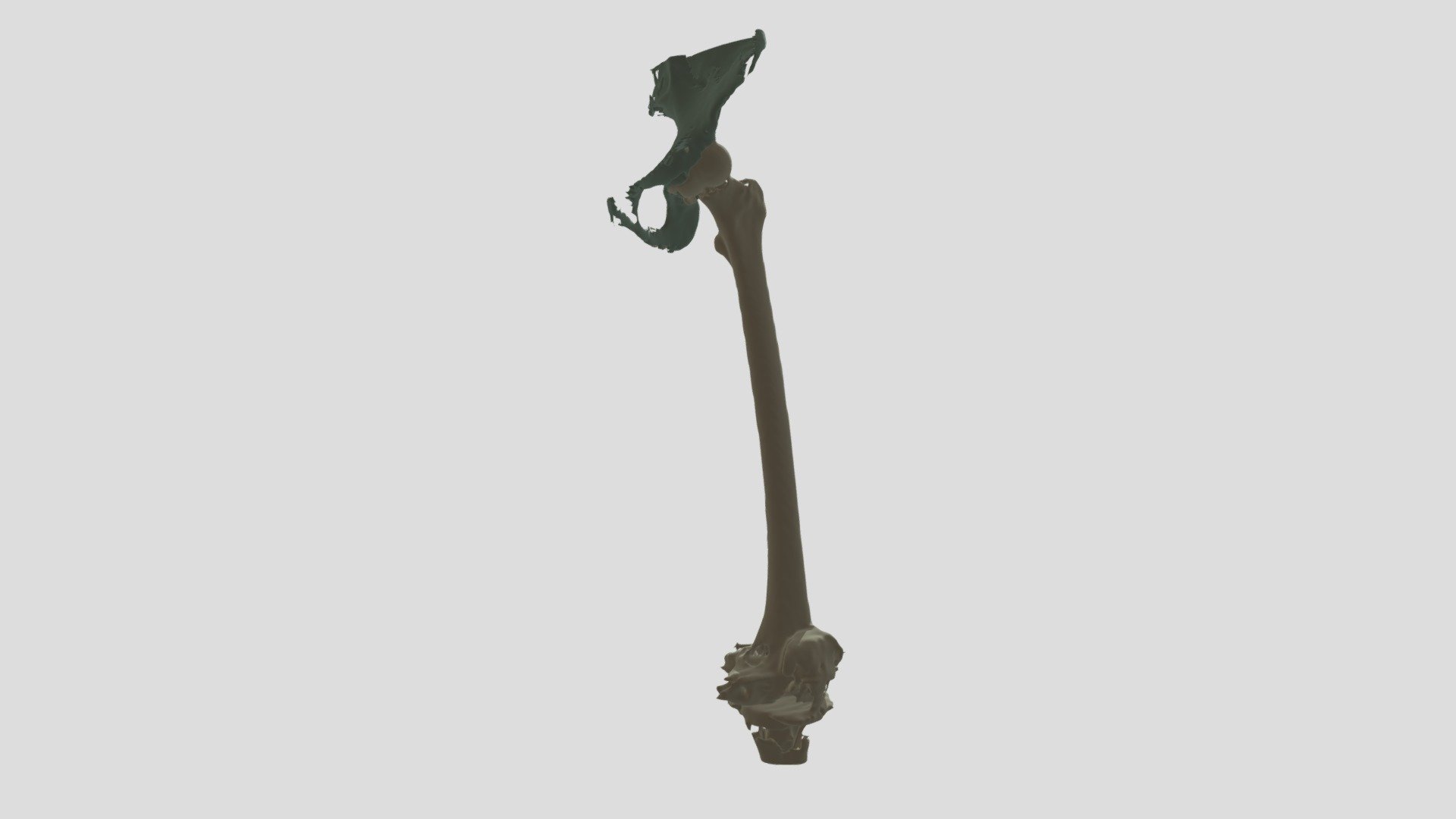 Leftfemur