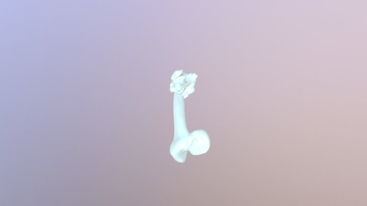 Left Femur 3D Model