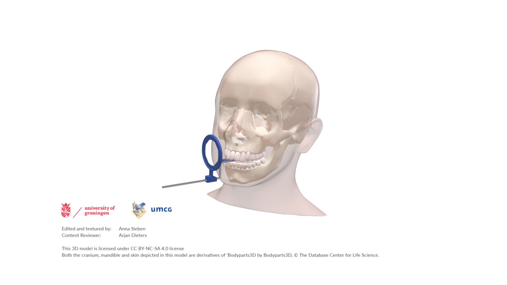 Dental Intra Oral X-ray Pos - empty annotation