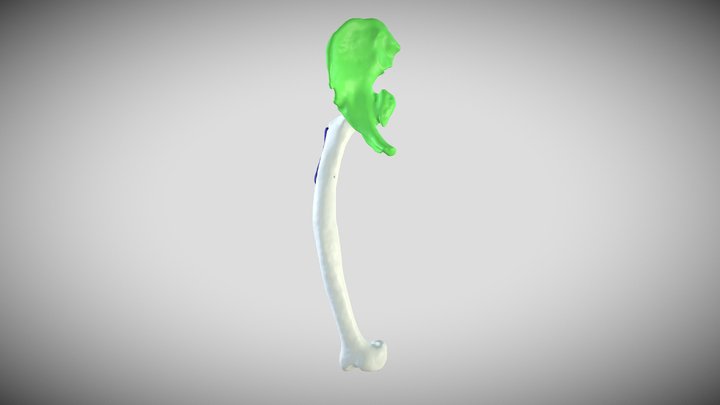 FEMURpelvisPLACA 3D Model