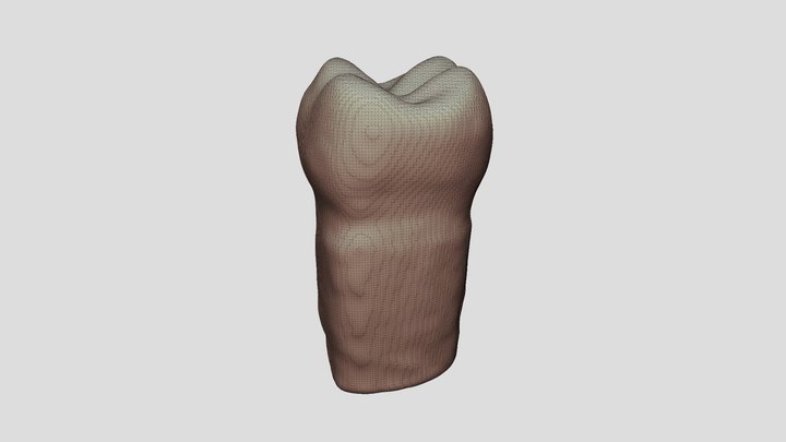 Molar Temporal 3D Model