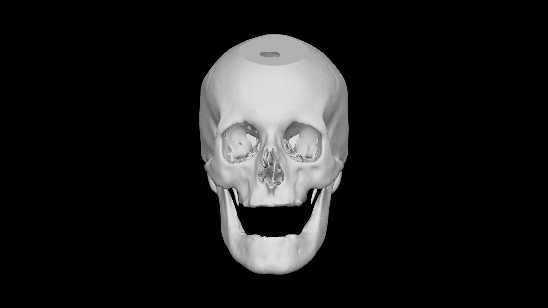 Skull Male 60yo
