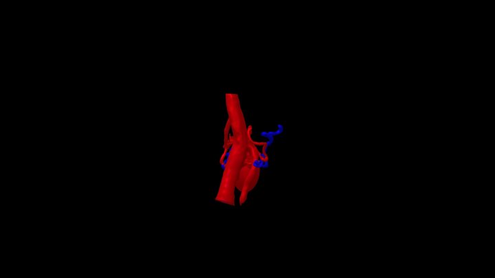 MAV Laterobulbar izquierda 3D Model