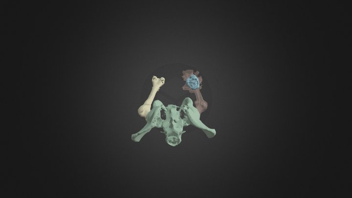 Femur and Pelvis segmentation 3D Model
