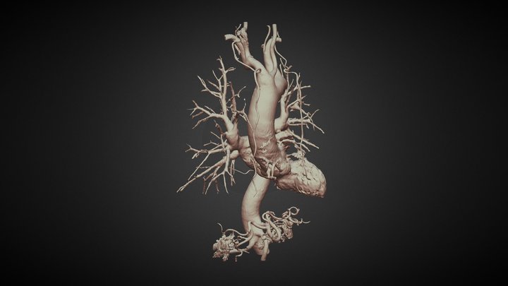 Aorta iodinated c.a. sing beam - not synchro CT 3D Model
