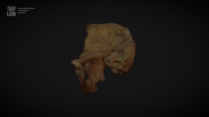 Achondroplastic dwarf - right pelvic bone 3D Model