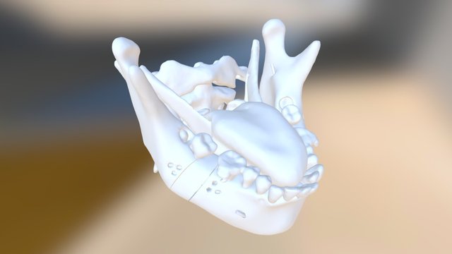 IMDO (After) 3D Model