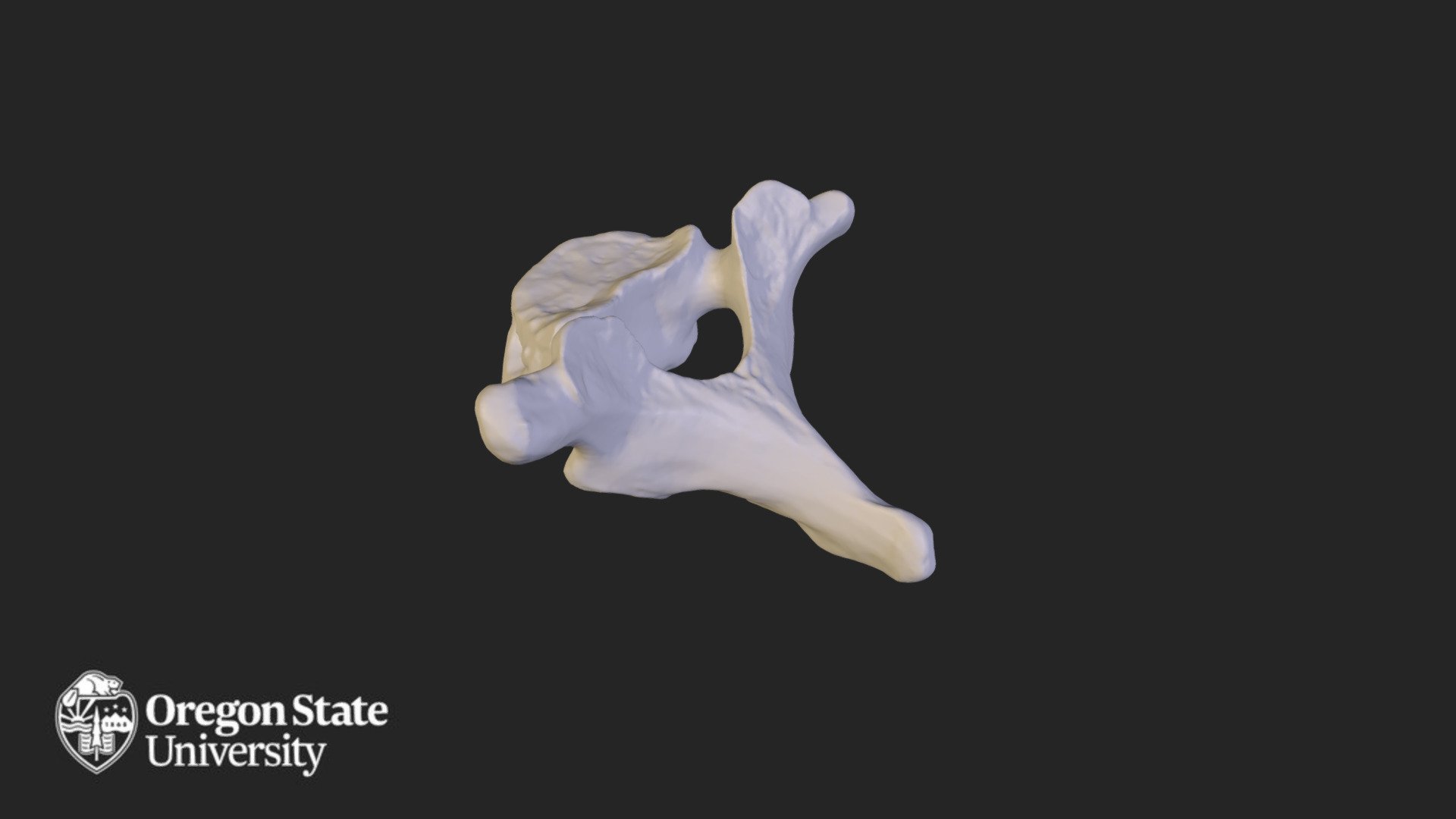 Thoracic vertebra - T1