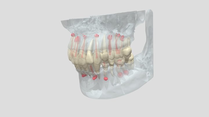 Surgical training model for endodontic treatment 3D Model