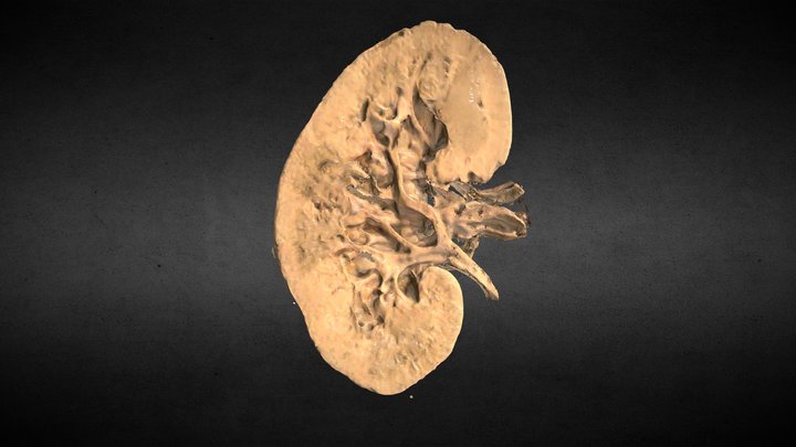 Corte frontal de riñón/Frontal kidney section 3D Model