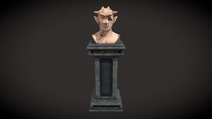 Pitted keratolysis 3D Model