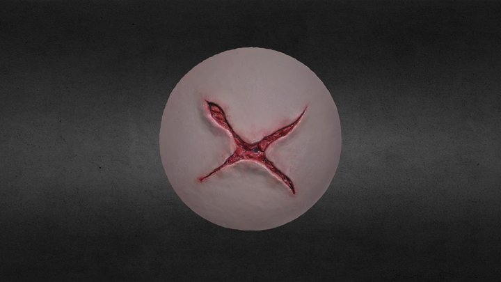 WOUND3 3D Model