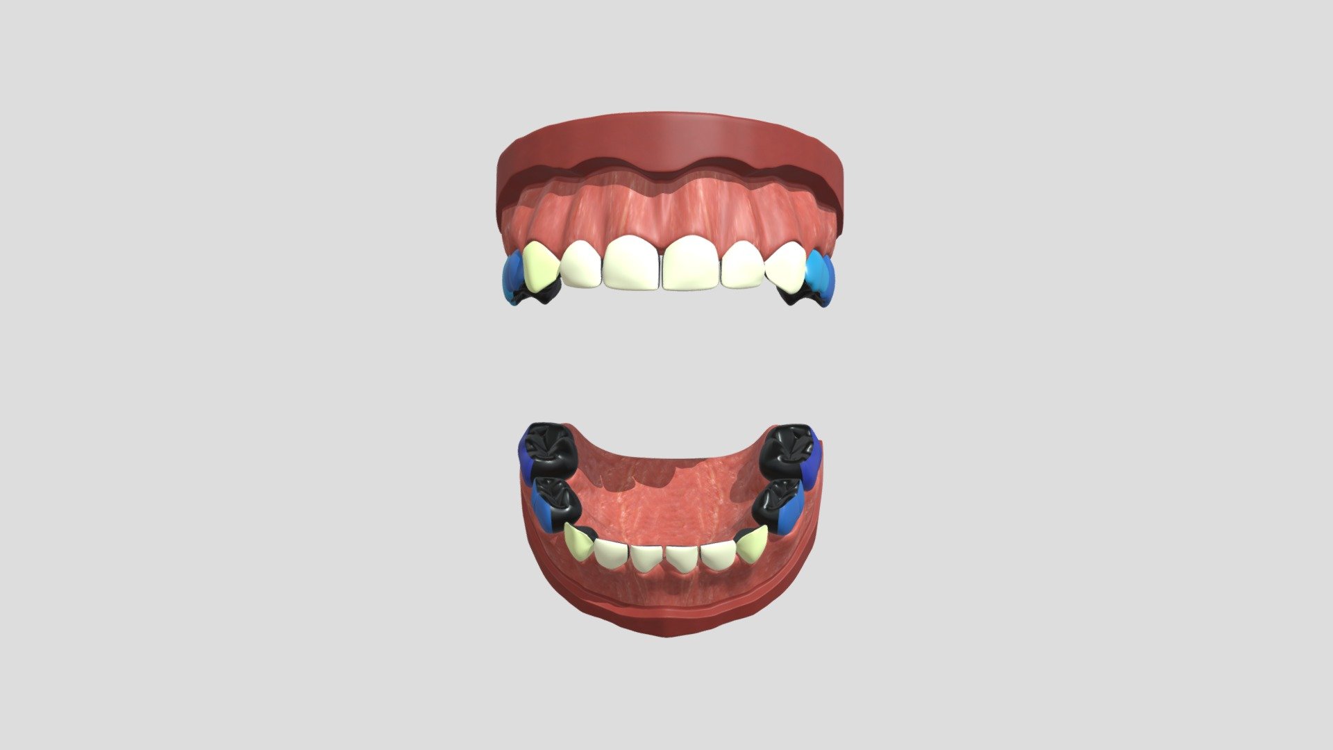 diff_nzunrestored_6cm_4c