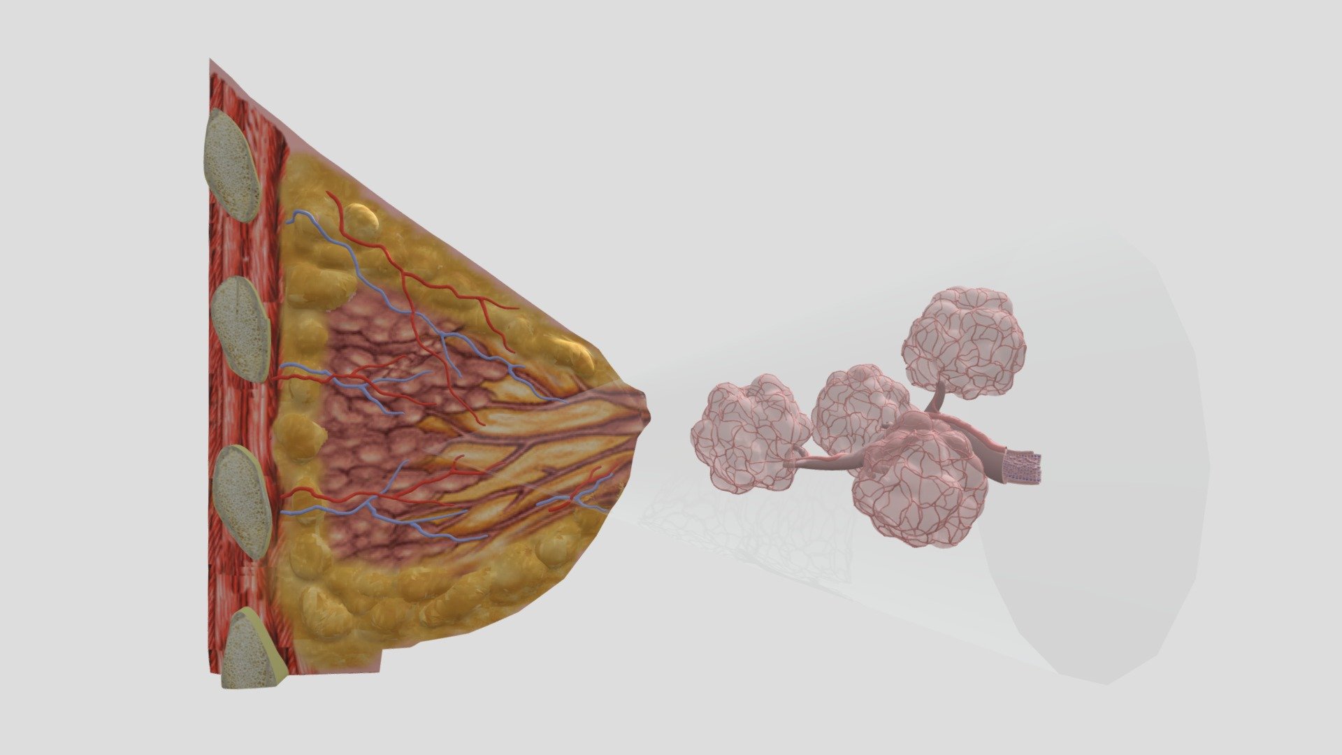 Breast XS and Lactiferous Duct with DCIS - 3D model by iqcenter ...