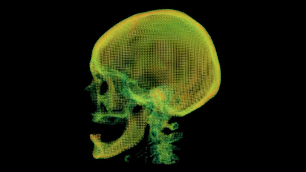 VHF Skull Point Cloud